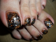 Лечение, профилактика вросших ногтей /онихокриптоз/, аппаратный педикю